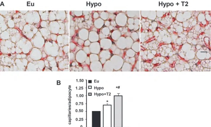 Figure 4. Effects of hypothyroidism and T2 administration to Hypo rats on BAT vascularization