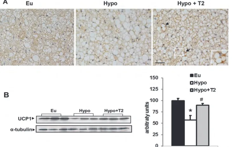 Figure 8. Effects of hypothyroidism and of T2 administration to hypothyroid rats on BAT UCP1 content