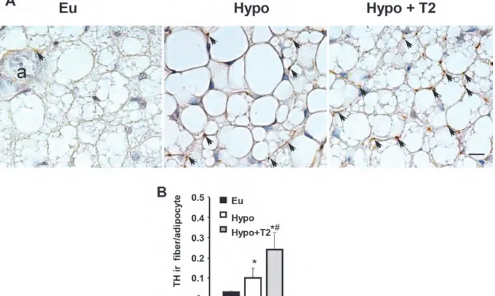 Figure 3. Effects of hypothyroidism and T2 administration to Hypo rats on BAT sympathetic innervation
