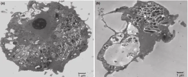 Figure 1 A. polyphaga infected with L. pneumophila. The multiplication of the latter was monitored by electron  microscopy after 18 (a) and 48 hours (b), [Lau et al., 2009]
