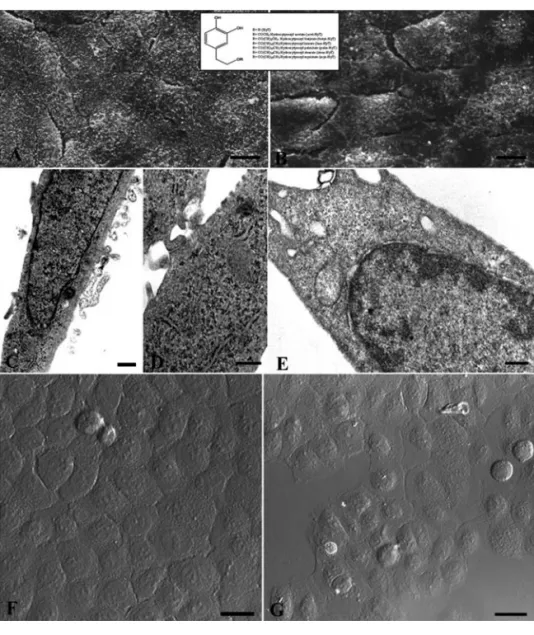 Figure 3. Mel (A,C,D) and Cr (B,E,F) treated cells before UVB exposure and observed at SEM (A,B), TEM (C,E) and CLSM (D,F)