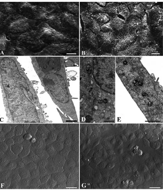 Figure 5. Laur-HyT (A,C,F), Myr-HyT (B,D,E,G) treated cells before UVB exposure and observed at SEM (A,B), TEM (C,D,E) and CLSM (F,G)