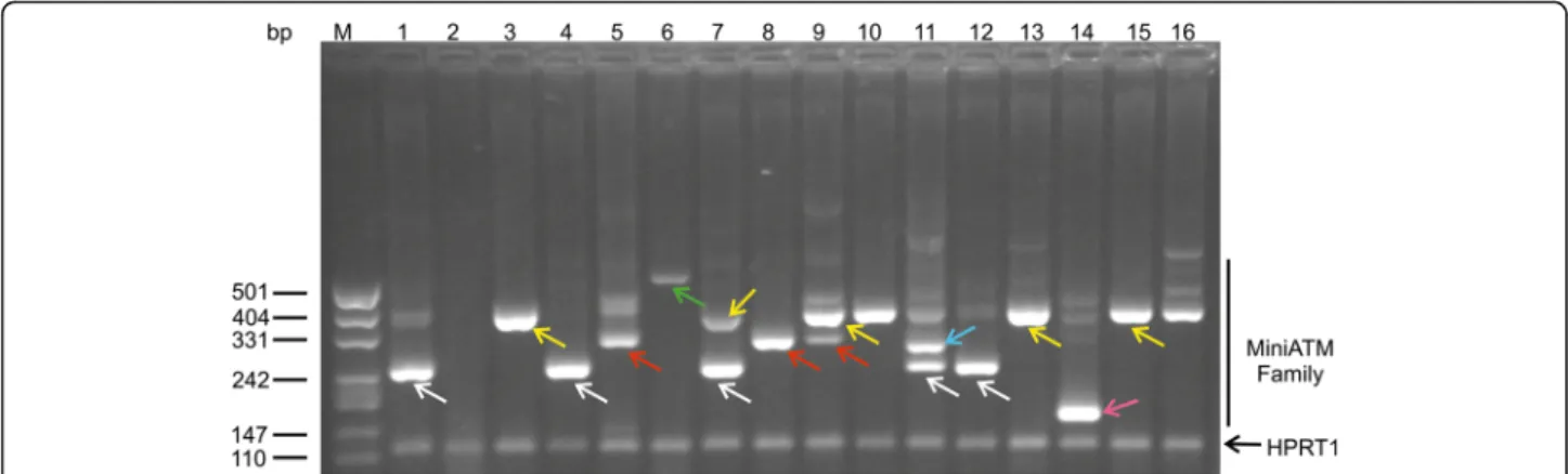 Fig. 4 ATMdexa1 transcript family. Amplicons obtained by 5 ′ nuclease qPCR of the compassionate EryDex samples analysed by electrophoretic gel