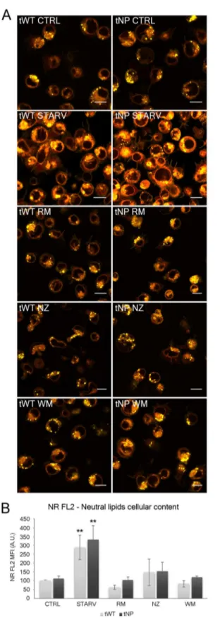 Fig 5. Evaluation of intracellular lipid content by Nile Red (NR). (A) Single confocal optical sections (~0.8 μm thickness) showing overlay of yellow (FL2) and red (FL3) NR fluorescence from all experimental conditions in tWT and tNP cells