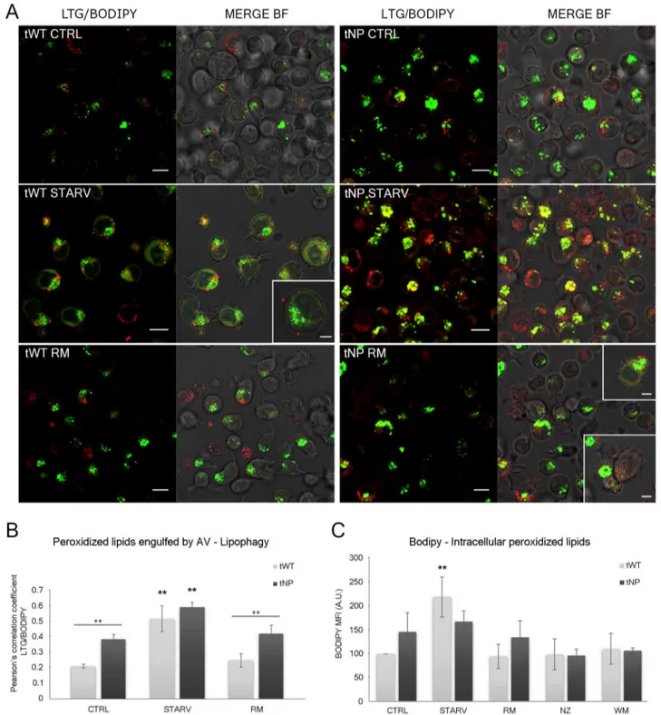Fig 6. Evaluation of intracellular lipid content and lipophagy by BODIPY ® 665/676 (BP)