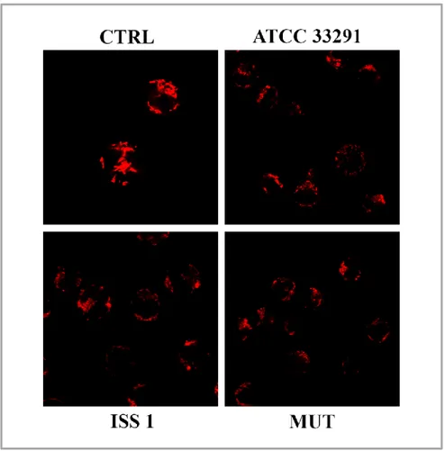 Fig. 6.6 Single confocal optical sections of TMRE MFI of uninfected cells and infected U937  cells at 72 hours