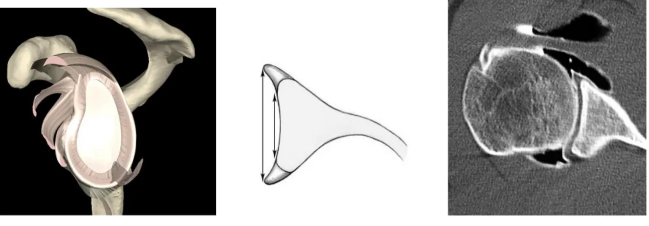 Fig. 9: Nelle immagini sopra si può osservare la “ventosa” gleno-omerale.  (http://www.medisaluser.com/pdf/instabilita.pdf) 