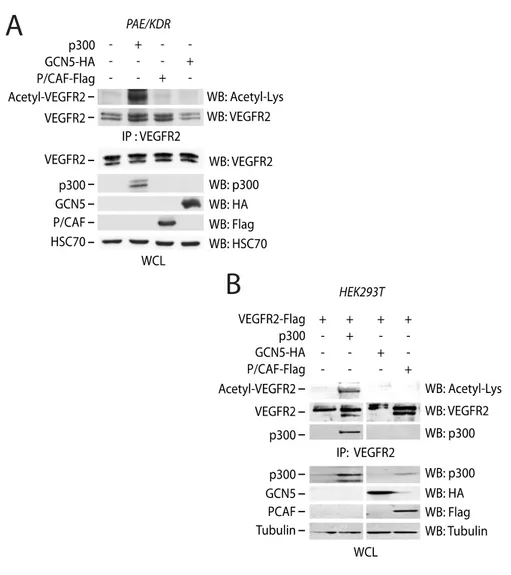 Figure 3.2. p300 induces VEGFR2 acetylation. (A) PAE/KDR cells were 