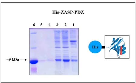 Figure  11.  SDS-PAGE  gel  (15  %)  stained  with  Coomassie  blue  showing  the  purification  of  the  ZASP  His-PDZ  protein