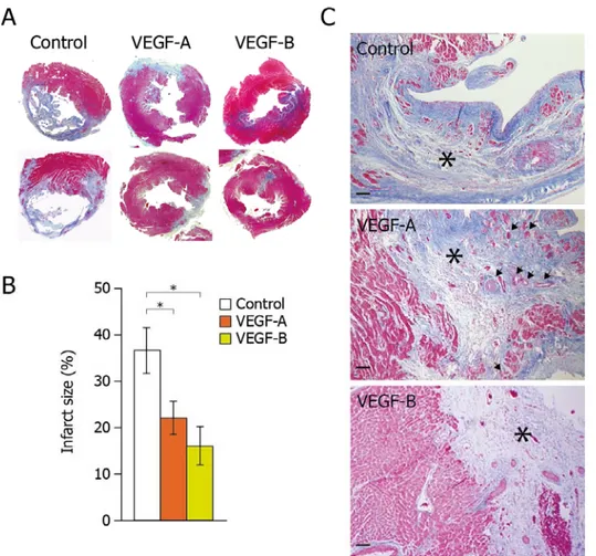 Figure  3.10  Morphometric  and  histological  analysis  of  infarcted  hearts  3  months  after  gene  transfer    A)  Representative  Azan  trichrome  staining  of  LV  transverse  sections  of  control,  AAV‐VEGF‐A and AAV‐VEGF‐B‐injected hearts. B) Qua