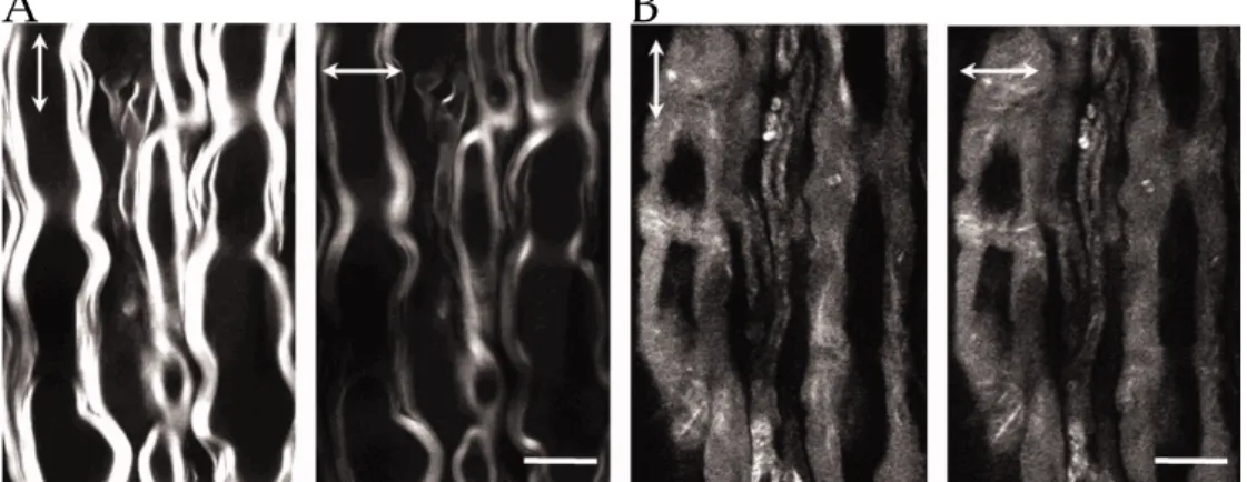 Figure 1.10: CARS images of normal myelin sheaths (A) and myelin sheaths exposed to lyso-PtdCho (B) acquired with vertical (vertical arrows) and horizontal (horizontal arrows) excitation polarisation