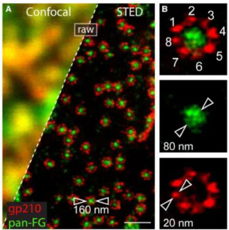 Figure  1.9  STED  imaging  of  NPC.  Comparison  of  conventional  confocal  microscopy  and 