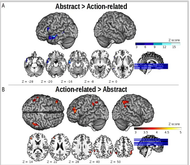 Figure 4.  Functional localization of the concreteness effects.  Significant activations (p  &lt; 0.05, FWE corrected for 