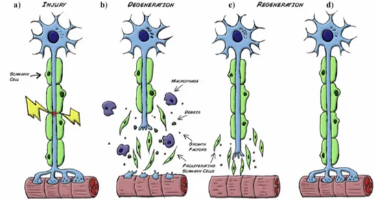 Figure 2.7 Wallerian degeneration. a) Following injury, b) Schwann cells detach from the  axons, start proliferating and help the recruited macrophages to clear the cellular and myelin  debris
