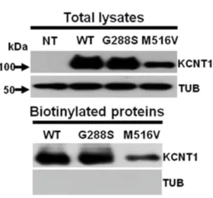 Figure	15	Biochemical	characterization	of	wild-type	or	mutant	KCNT1	channels.	Representative	images	of	western-