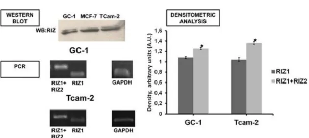 Figure A1. RIZ expression in GC-1 and TCam-2 cell lines. Western blot analyses of total protein cell  extracts  from  GC-1  and  TCam-2  cell  lines  with  RIZ1  antibody