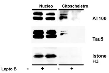 Fig. 6A – Western blot sulle frazioni cellulari (citoscheletrica e  nucleare) di  cellule MEF wild  type trattate  con  la  Leptomicina  B  (inibitore  dell’esporto  nucleo-citoplasma)