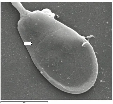 Figure  2.4.  Picture  of  rabbit  spermatozoa  head  obtained  by  scanning  electron 