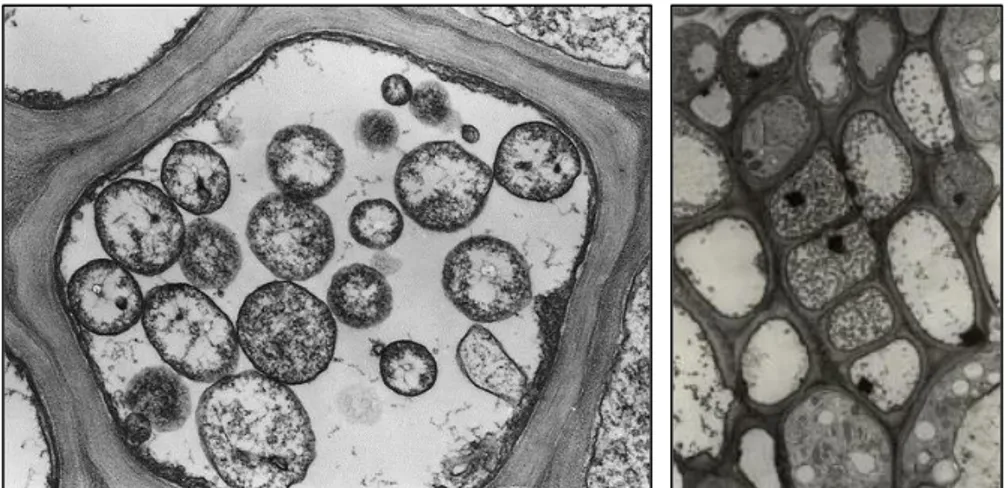 Figure 2. Electron micrograph of phytoplasmas in sections of sieve tubes.  (A. Bertaccini, http://www.costphytoplasma.ipwgnet.org/WG1/WG1_photogallery.htm) 