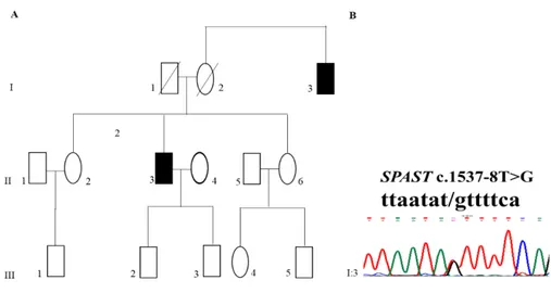 Figura 5: (A) Albero genealogico: (II:3) probando (I:3) zio materno del probando  con sintomatologia assimilabile a quella del probando