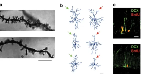 Figure 8. Stress alters several forms of neuroplasticity including adult neurogenesis