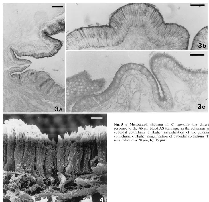 Fig. 4 Scanning electromicrograph of the columnar epithelium in C. hamatus. Note the apical microvilli