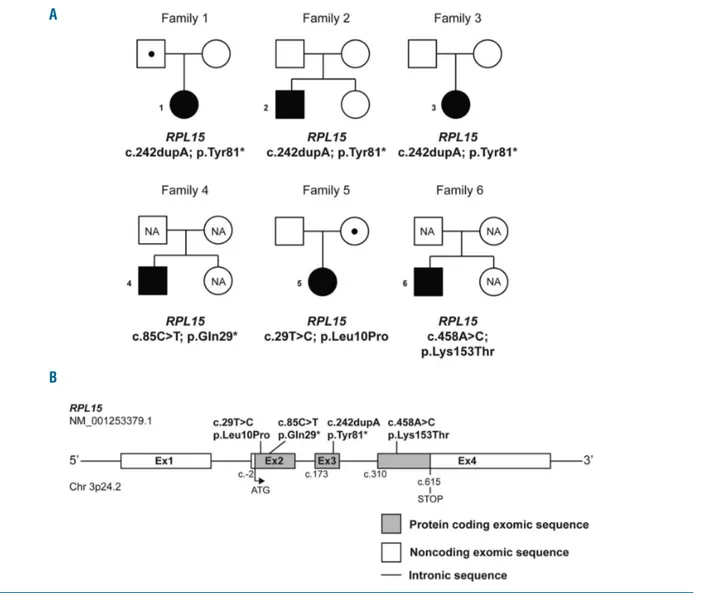 Figure 1. Mutations in RPL15 are identified in patients with Diamond-Blackfan anemia (DBA)