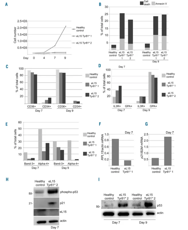 Figure 5. Erythroid cell culture assays of primary RPL15 c.242dupA erythroid progenitor and precursor cells reveal severe erythroid proliferation defects, differen- differen-tiation delays, and TP53-related apoptosis