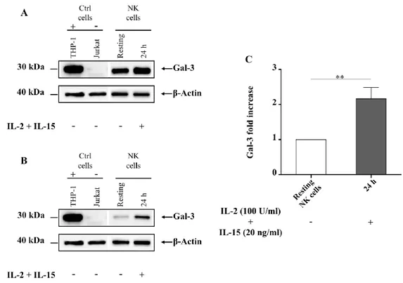 Figure  9.  Gal-3  protein is  expressed in  human  NK  cells and  its expression  increases  upon cell activation