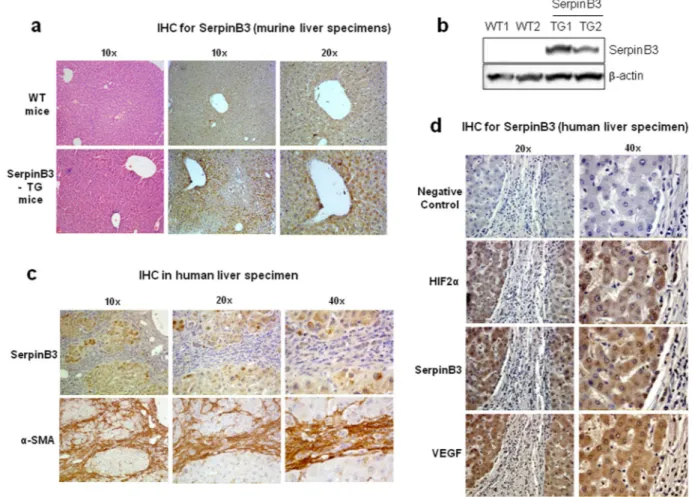 Figure 4.  SerpinB3 overexpression in TG mice and human liver specimens from HCV patients