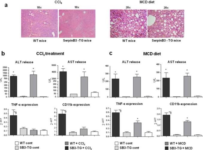 Figure 5.  Parenchymal injury and inflammatory markers in SerpinB3 transgenic (SB3-TG) mice and wild 