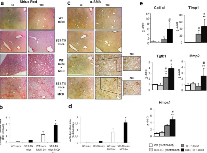 Figure 7.  Liver fibrosis “in vivo” in SerpinB3 transgenic (SB3-TG) mice vs wild type (WT) mice fed with MCD 