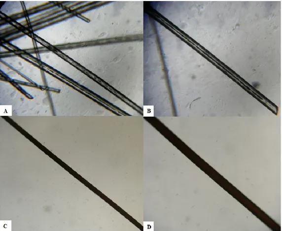 Figure 2. Light microscopic examination of hair shafts of the proband (A,B) and of a healthy control 