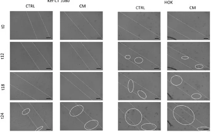 Figure V-2 Pictures show skin and oral keratinocytes response to hMSC CM. White circle point keratinocytes migration area