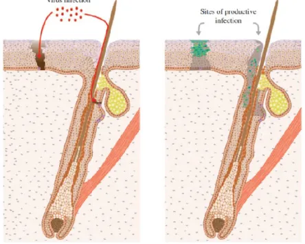 Figure 7. To initiate infection, HPV virions must gain access to the epithelial basal cells and probably  an  epithelial  stem  cell  localized  in  the  bulge  region  (coloured  purple),  either  through  a  wound  or  possibly through the hair follicle 