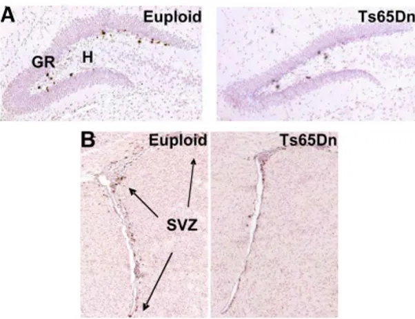 Figure  7.  Representative  pictures  of  proliferation  impaired  in  the  dentate  gyrus  (DG,  A)  and 