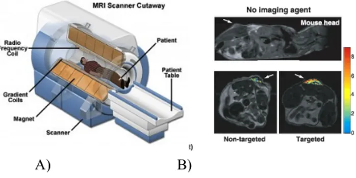 Figure 4: Magnetic resonance imaging (MRI)  