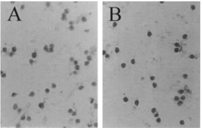 Fig. 4. MSH2 immunoreactivity in cerebellar granule cells in basal condition (A) and after exposure to 100 mM glutamate (B)