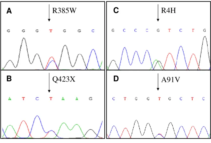 Figure  3.1:  On  the  left  electropherograms  of  the  variations  R385W  (A)  and  Q423X  (B),  carried  by  two  different  CIDP  patients