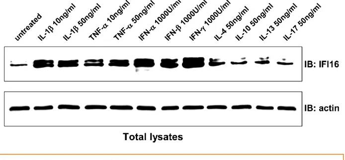 Figure 7: Modulation of IFI16 protein levels by cytokines in primary human  endothelial cells