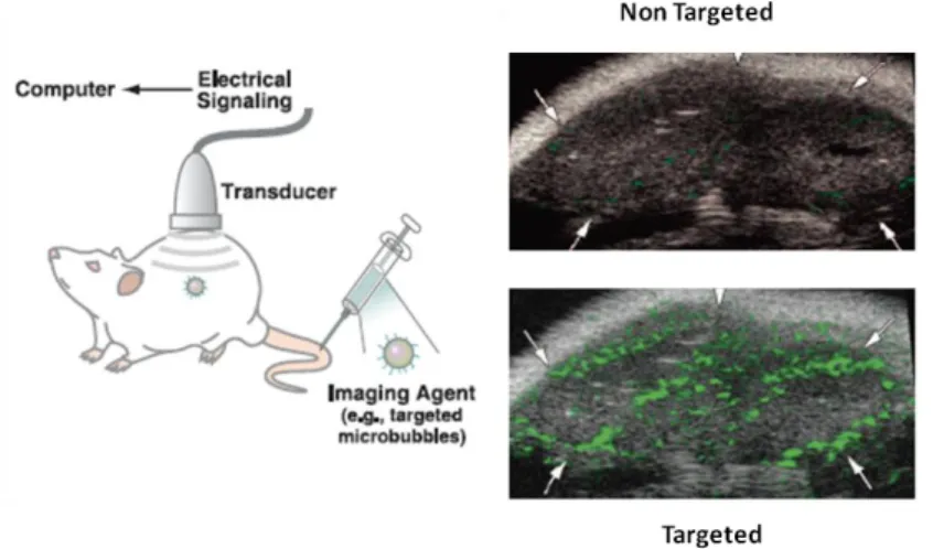 Figure  3.  Schematic  illustrating  the  general  principles  of  molecular  imaging  using  US