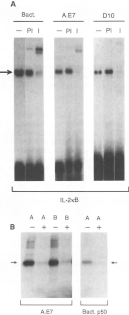 Fig. 1. The KB binding complexes and IL-2 1R.