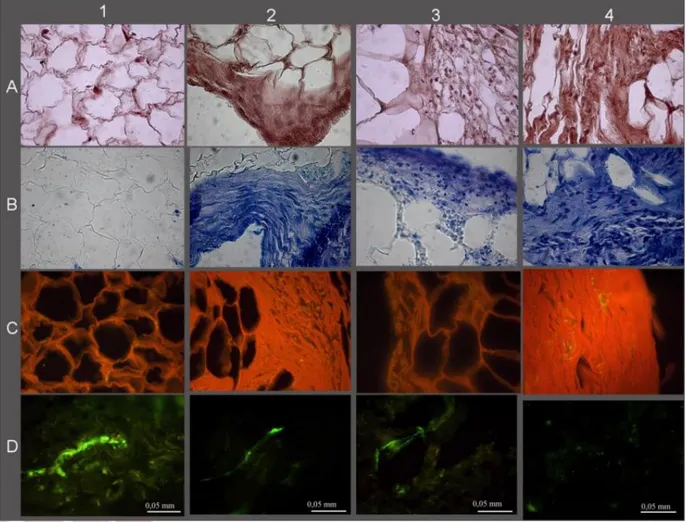 Figure  7:  Histological  and  histochemical  results;  A-Hematoxylin/Eosin;  B-Toluidine Blue;  C-Sirius  Red;   D-VonWillebrand