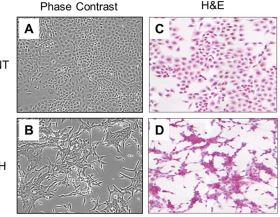Figure 1: Morphological characterization and growth rate of RNT and RH cells.  Phase-contrast microscopy and H&amp;E  staining of cultured RNT A., C