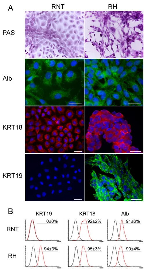 Figure 2: Profiling of typical hepatocyte markers in RNT and RH cells.  A. Microphotographs showing positivity for glycogen  (PAS staining); A., B