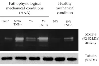 Figure 7. Strain affect MMP-9 expression and activity (a) Representative zymography assay to detect 