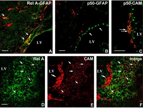 Fig. 4. Phenotypic characterization of Rel A and p50 expressing cells in the adult telencephalon