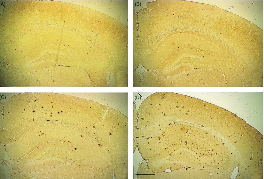 Fig. 1 shows representative coronal sections from 9, 15, 25, and 40–50 week-old mice. There was little evidence of A ␤