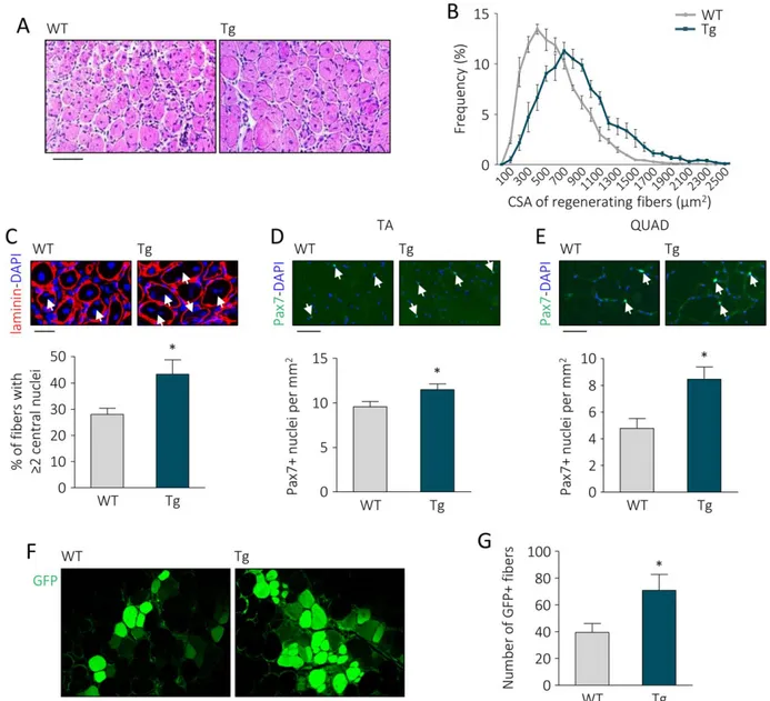 Figure 1. UnAG upregulation in Myh6/Ghrl transgenic mice enhances muscle regeneration, increases satellite cell (SC) number in non- non-injured muscles, and improves SC engraftment