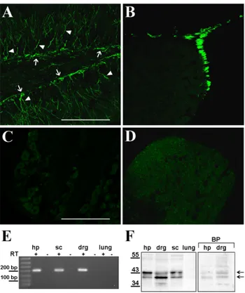 Fig. 2. Doublecortin (DCX) expression in adult mouse dorsal root ganglia (DRG) and spinal cord (SC) is conﬁrmed by  immunohisto-chemistry, by reverse transcription-polymerase chain reaction  (RT-PCR), and by Western blot analysis